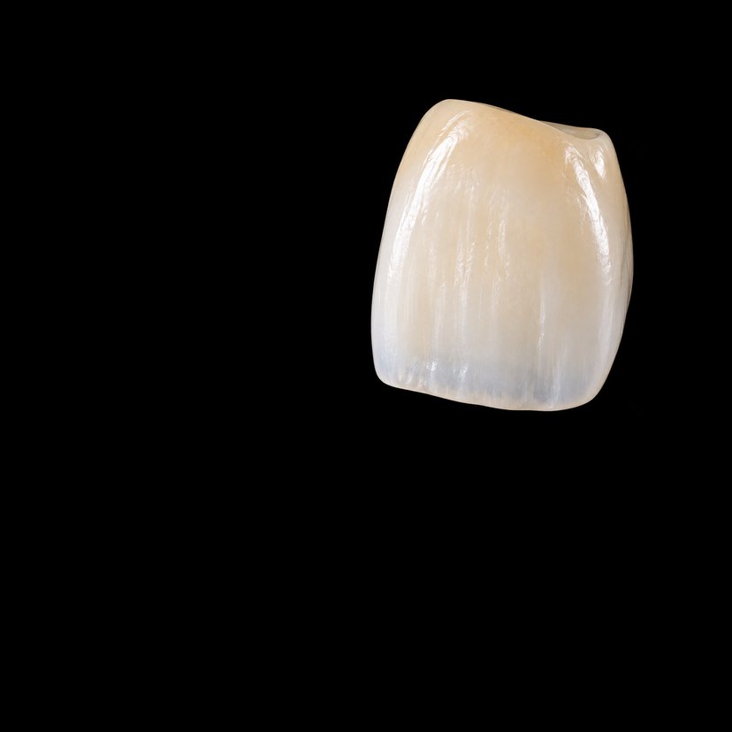 黒い背景に置いた、前歯のジルコニアセラミックのかぶせ物の CG